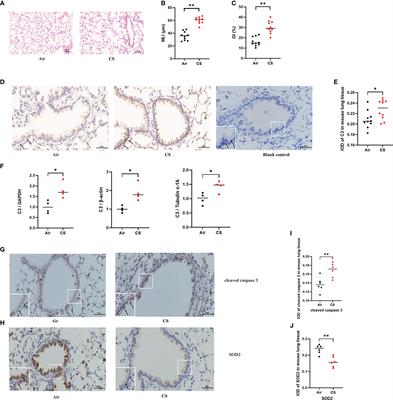 Complement component 3 protects human bronchial epithelial cells from cigarette smoke-induced oxidative stress and prevents incessant apoptosis